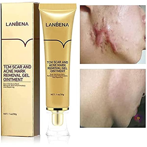 Kem mờ mẹo Lanbena