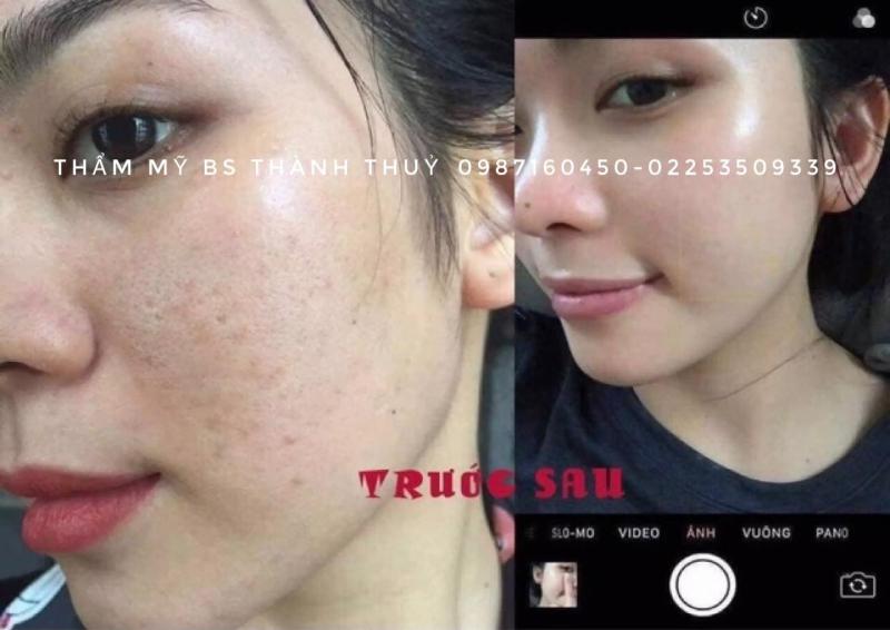 Thẩm mỹ bác sĩ Thành Thủy