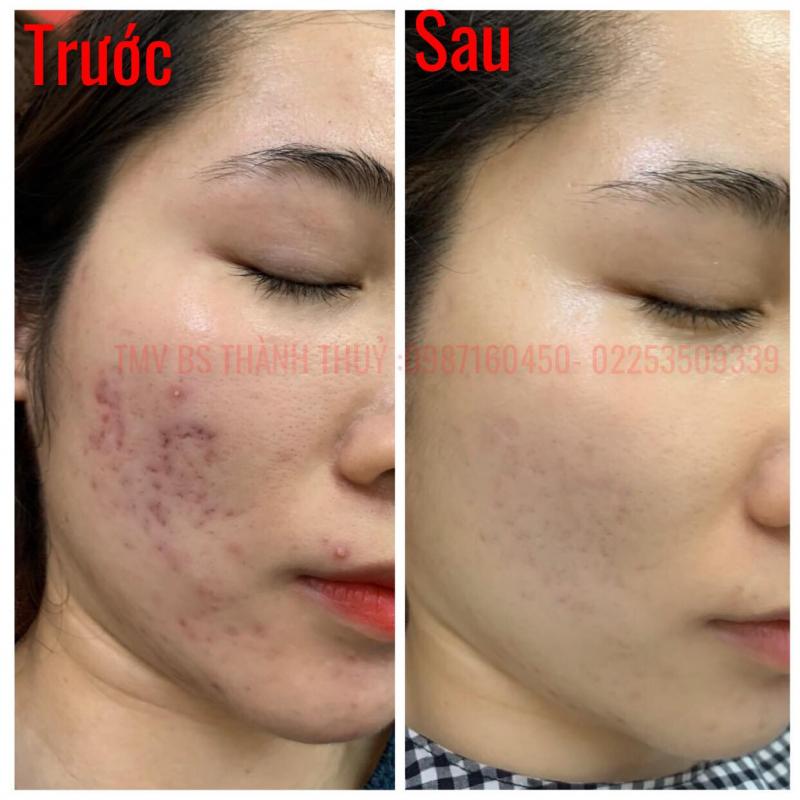 Thẩm mỹ bác sĩ Thành Thủy