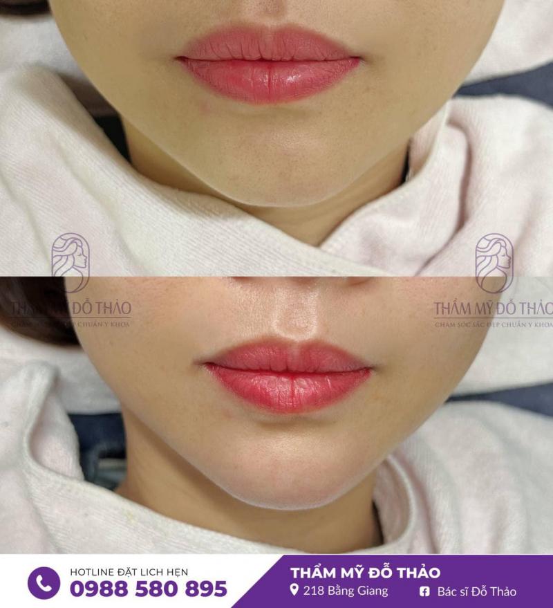 Thẩm mỹ Đỗ Thảo