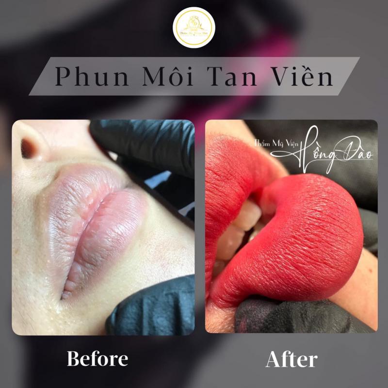 Thẩm Mỹ Hồng Đào