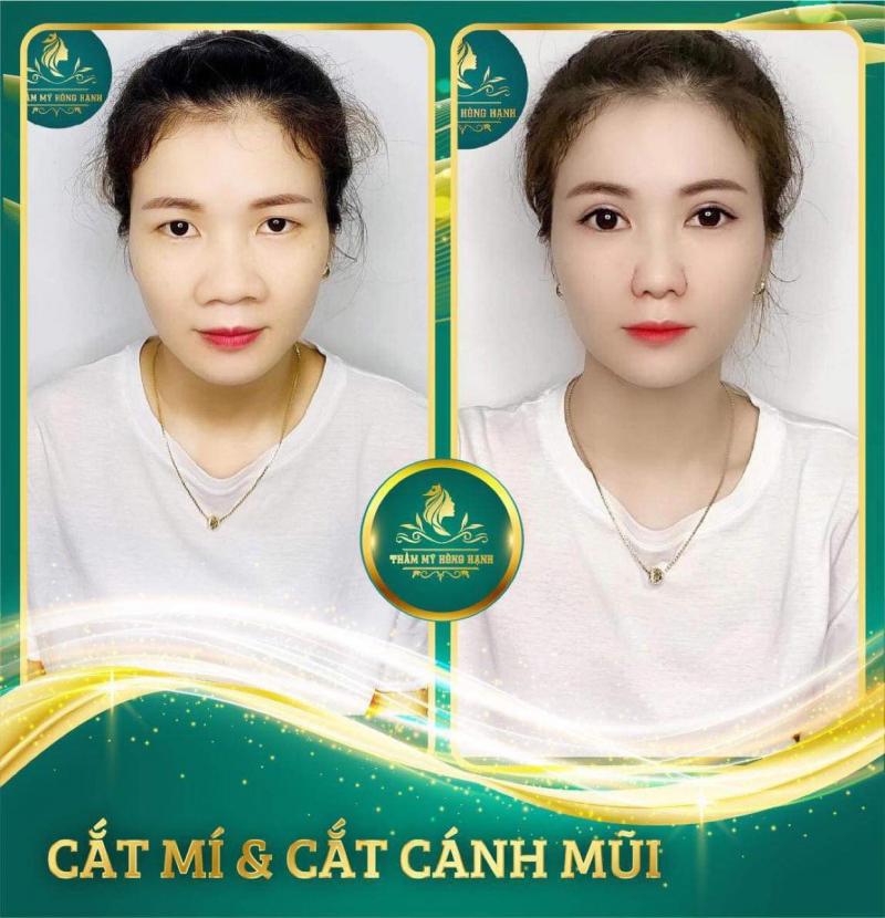 Thẩm Mỹ Hồng Hạnh Đà Nẵng