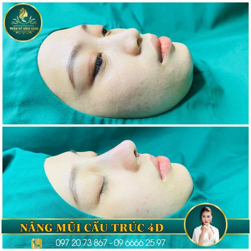 Thẩm Mỹ Hồng Hạnh Đà Nẵng