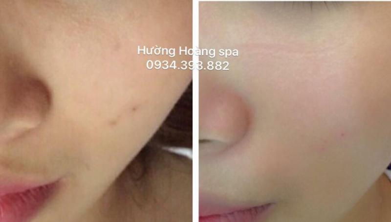 Thẩm mỹ Hường Hoàng
