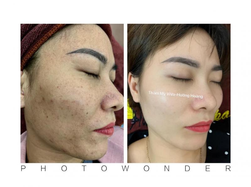 Thẩm mỹ Hường Hoàng