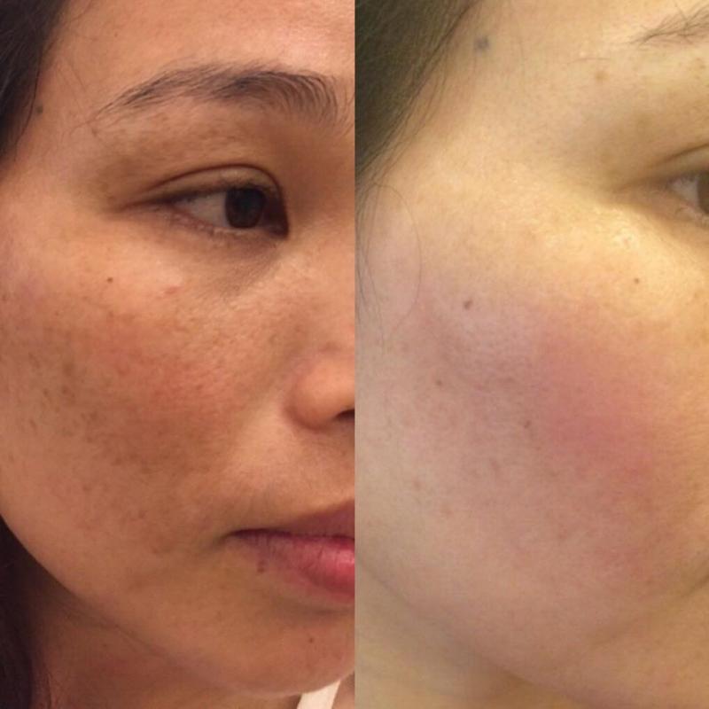 Thẩm Mỹ Lavenia Vinh