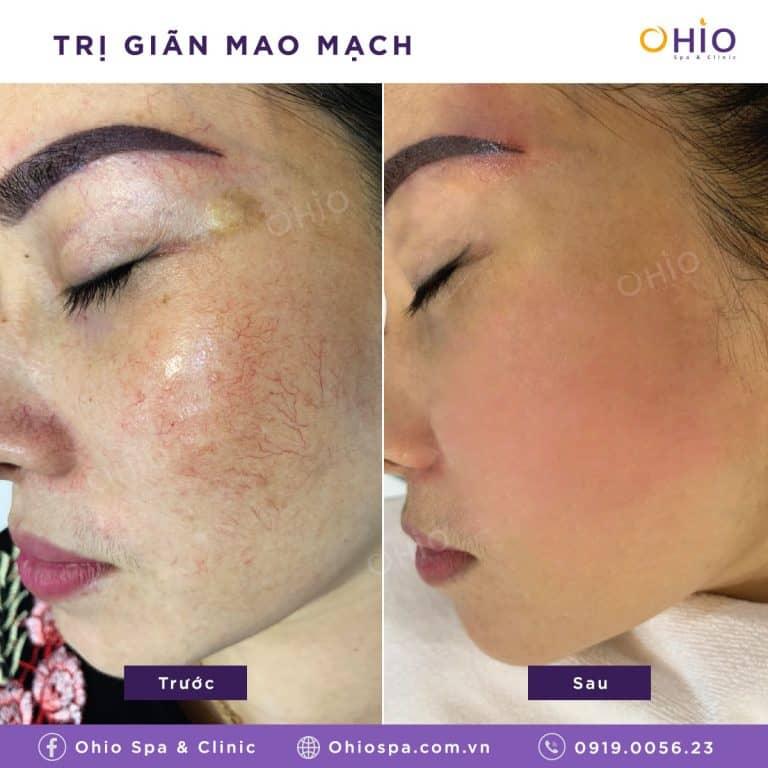 Thẩm mỹ OHIO
