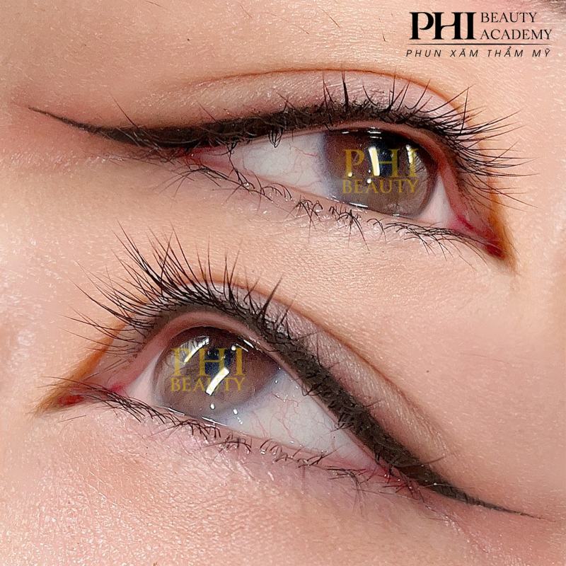 Thẩm Mỹ Phi Beauty