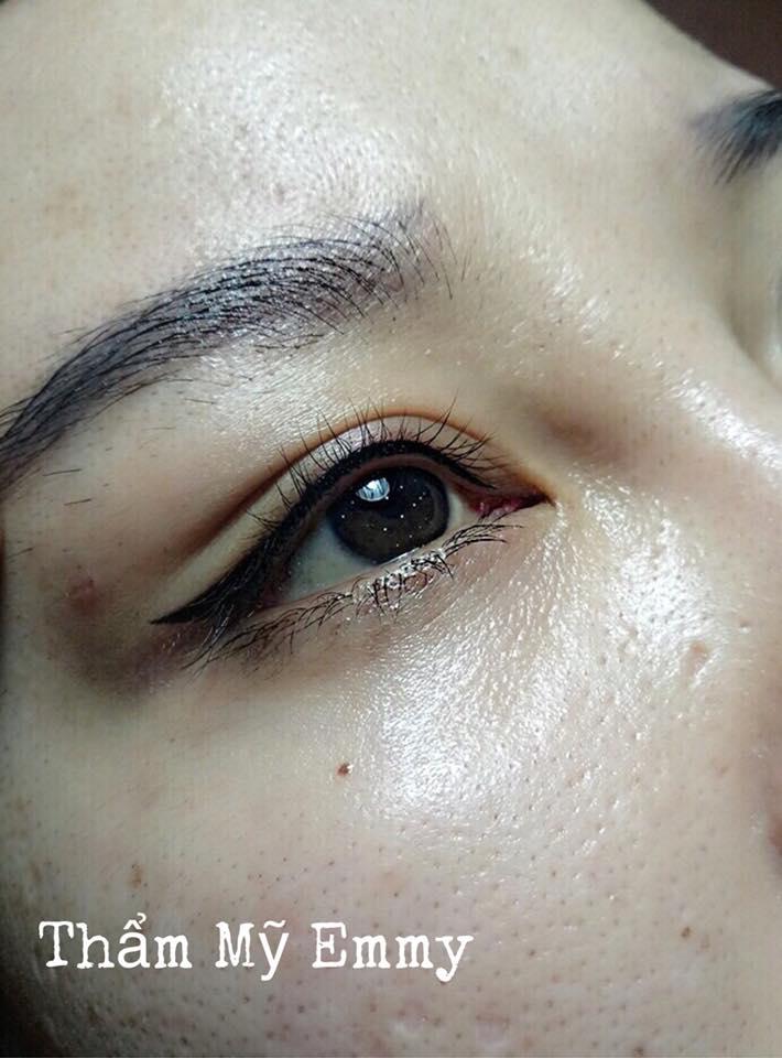 Thẩm Mỹ Quốc Tế Emmy