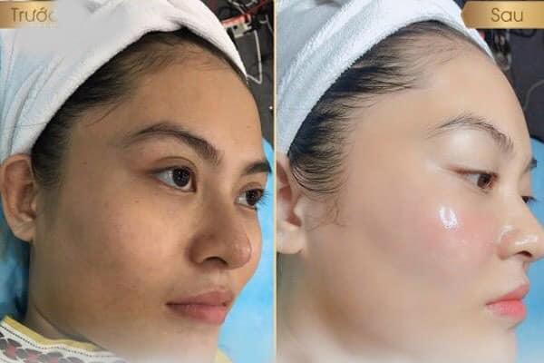 Thẩm Mỹ Quốc Tế Hoàn Mỹ