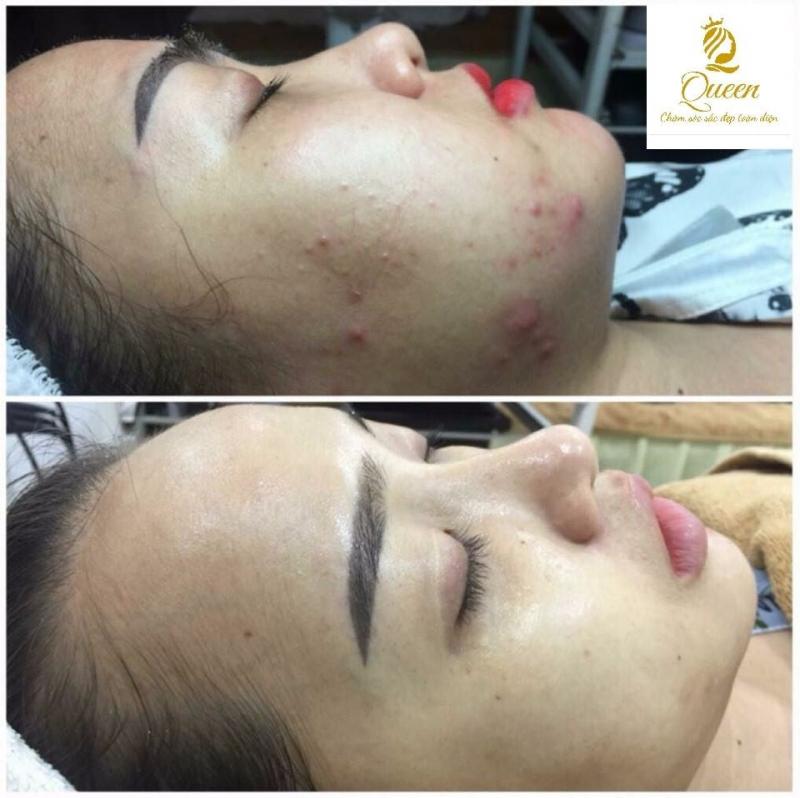Thẩm Mỹ Quốc Tế Queen Hà Tĩnh