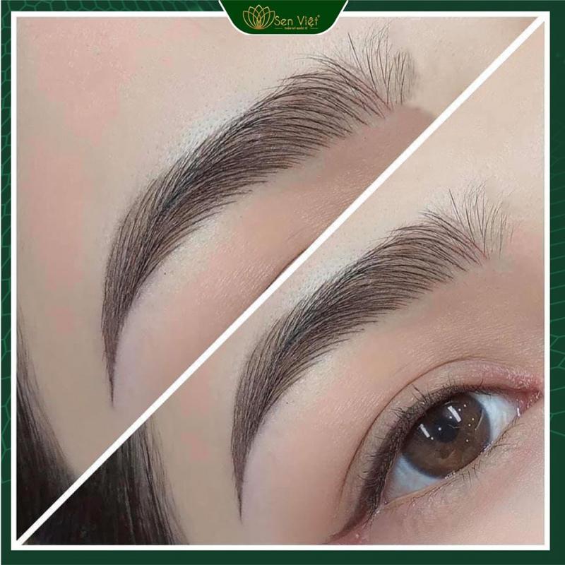 Thẩm Mỹ Quốc Tế Sen Việt - Hạ Long