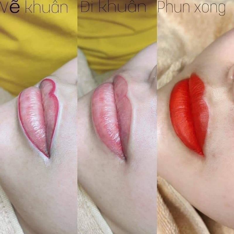 Thẩm Mỹ Sala
