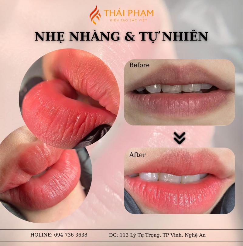 Thẩm Mỹ Thái Phạm