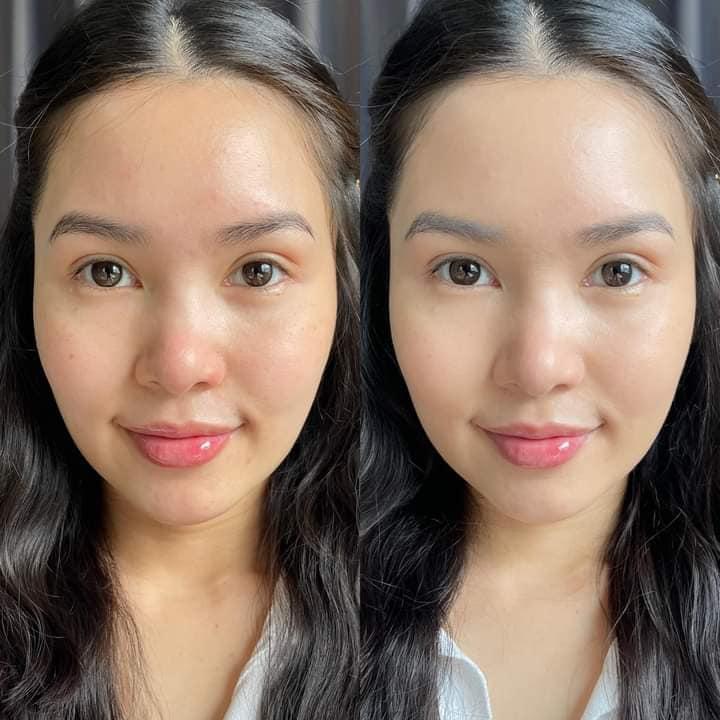 Thẩm Mỹ Viện Alisa Bắc Giang