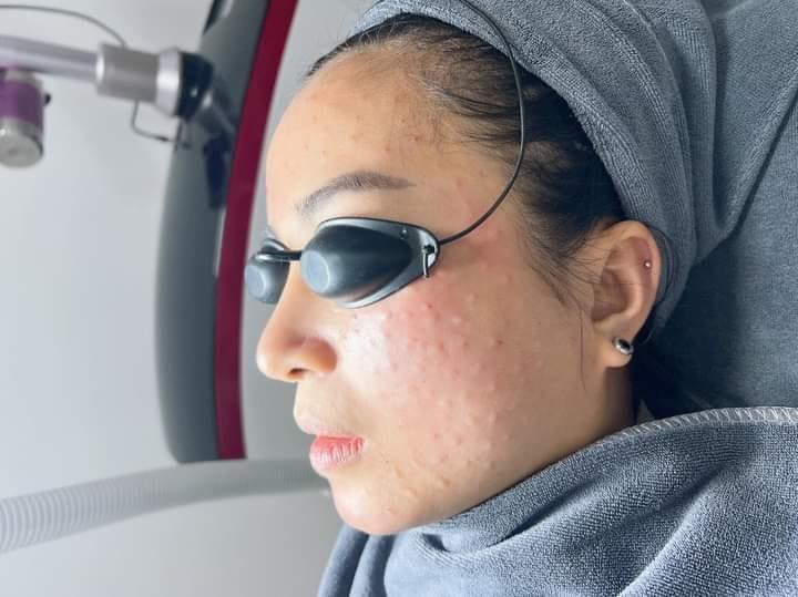 Thẩm Mỹ Viện Alisa Bắc Giang