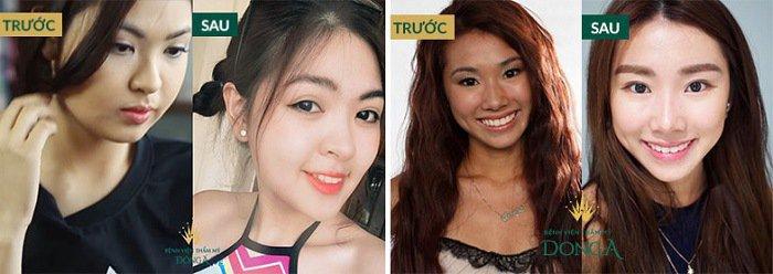 ﻿  Thẩm mỹ viện Đông Á