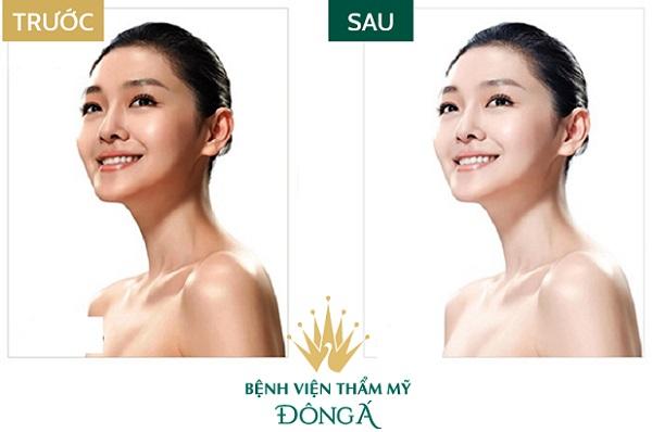 ﻿  Thẩm mỹ viện Đông Á