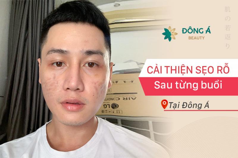 Thẩm Mỹ Viện Đông Á Hải Phòng
