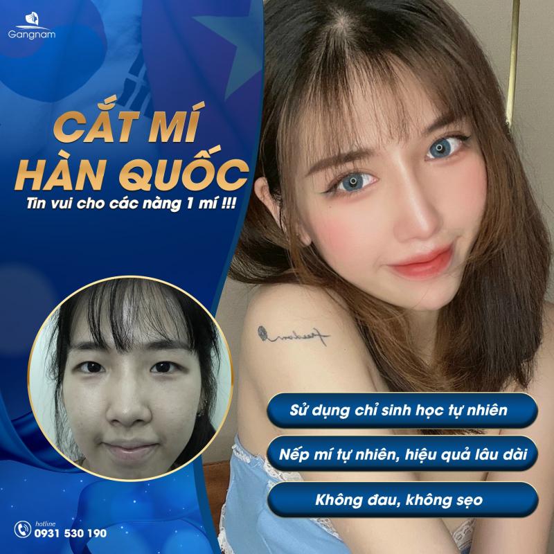 Thẩm Mỹ Viện Gangnam
