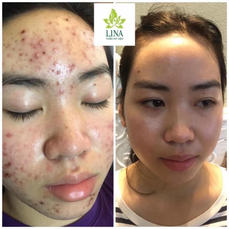 Thẩm Mỹ Viện Hàn Quốc LINA