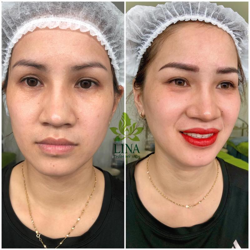 Thẩm Mỹ Viện Hàn Quốc LINA