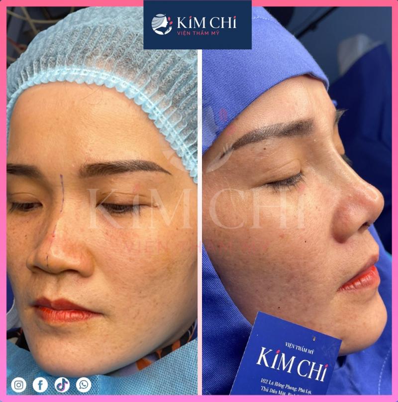 Thẩm mỹ viện Kim Chi