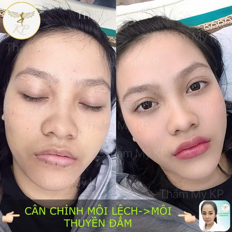 Thẩm Mỹ Viện KP