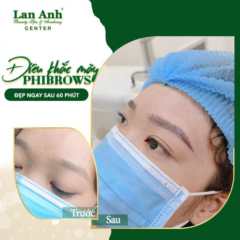Thẩm Mỹ Viện Lan Anh Bình Dương
