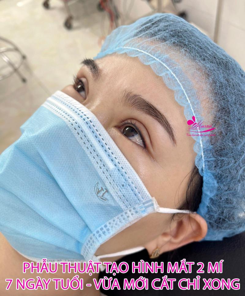 Thẩm Mỹ Viện Mailisa Cần Thơ