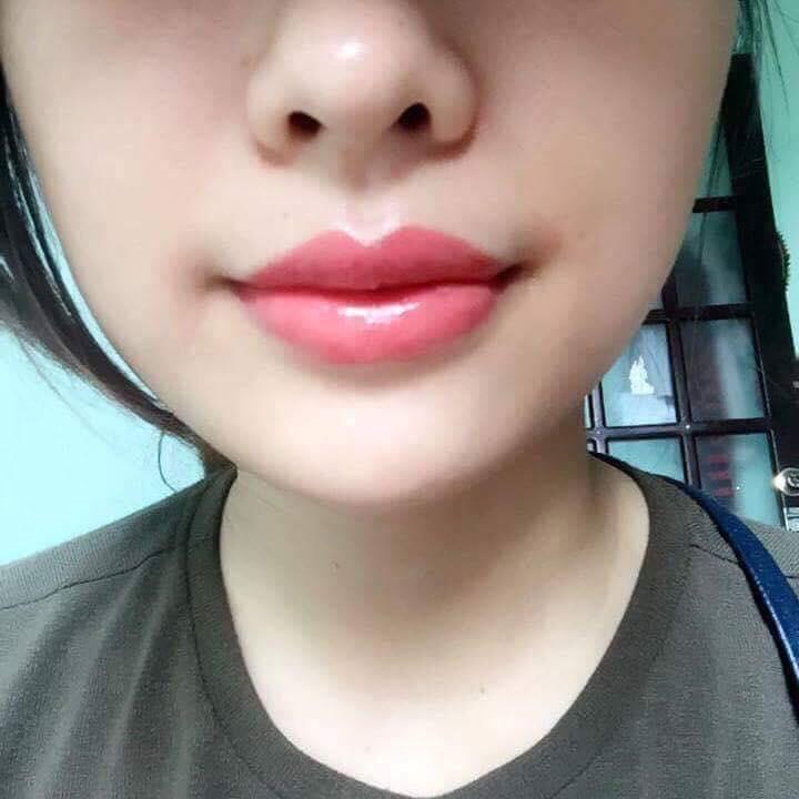 Thẩm mỹ Lavenia Vinh