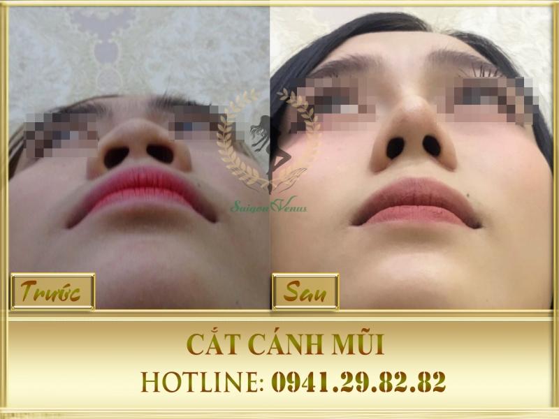 Thẩm mỹ viện Sài Gòn Venus - Thạc sỹ - Bác sỹ Nguyễn Tiến Huy