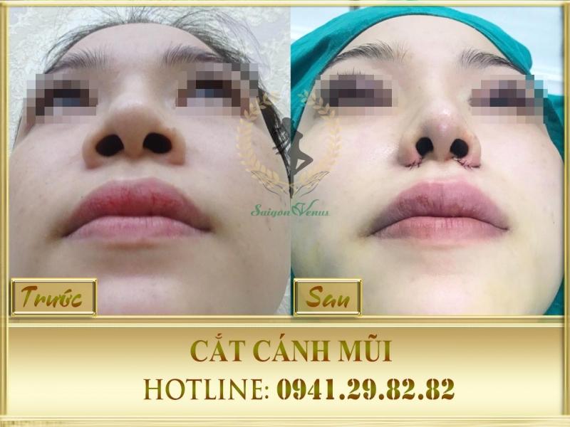 Thẩm mỹ viện Sài Gòn Venus - Thạc sỹ - Bác sỹ Nguyễn Tiến Huy