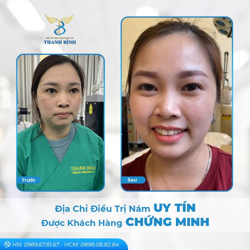 Thẩm mỹ viện Thanh Bình