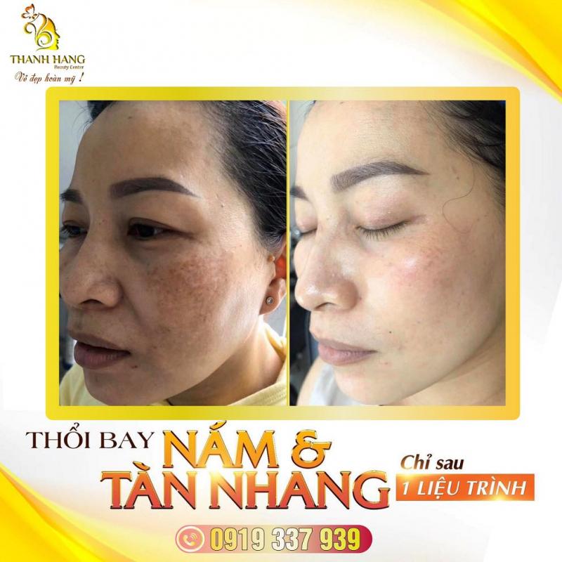 Thanh Hằng Beauty