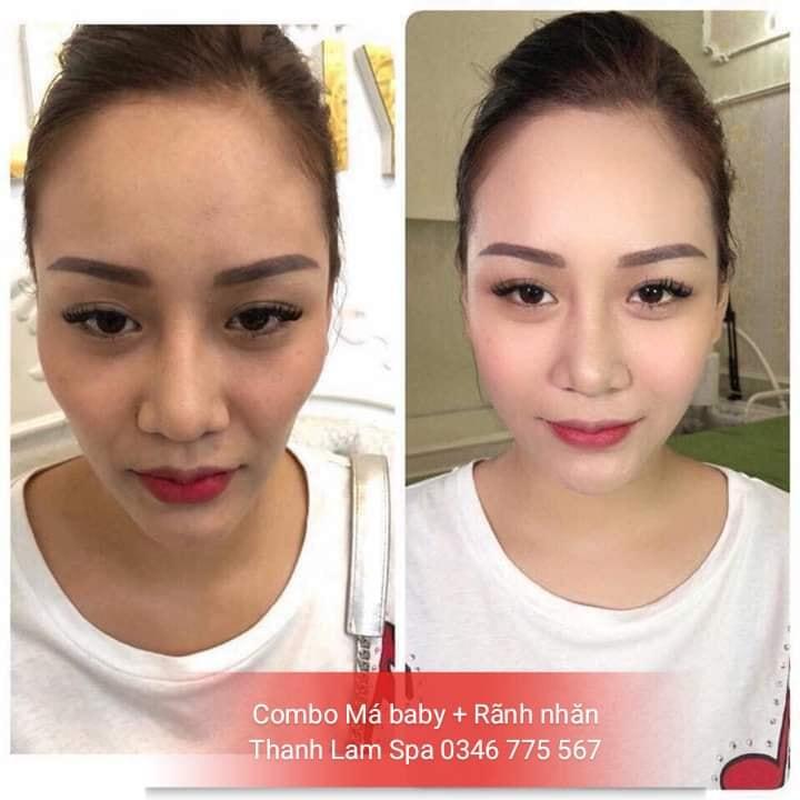Thanh Lam Spa