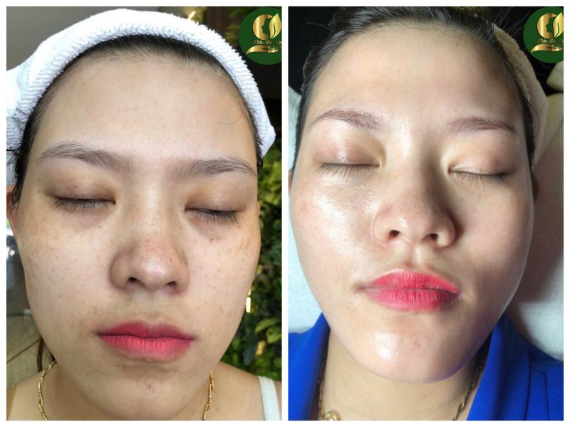 Thảo Mộc Xanh Spa & Clinic