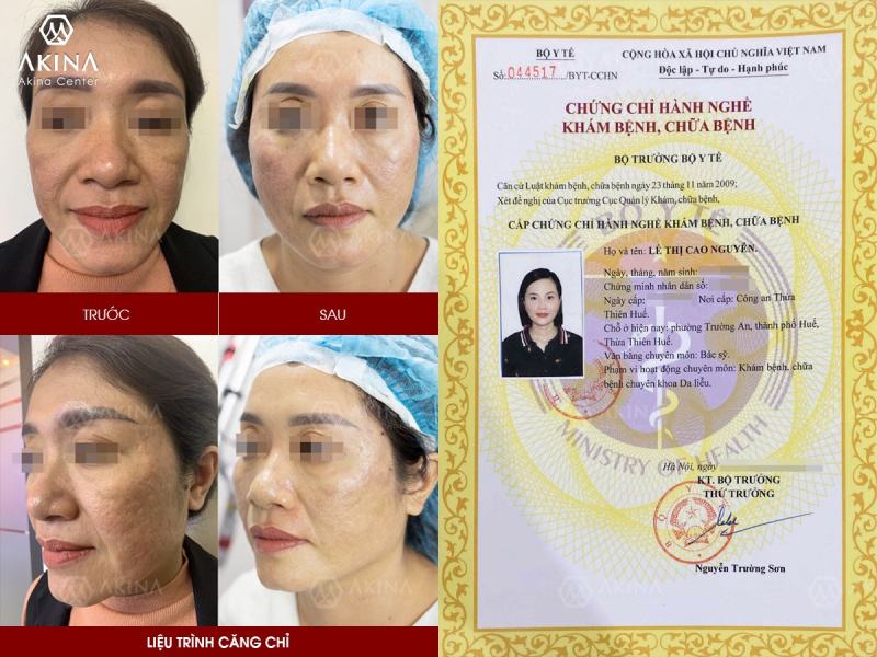 THS. BÁC SỸ LÊ CAO NGUYÊN – THS. BS DA LIỄU THẨM MỸ NỘI KHOA