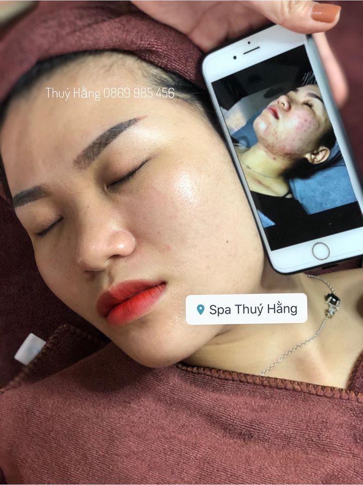 Thuý Hằng Spa