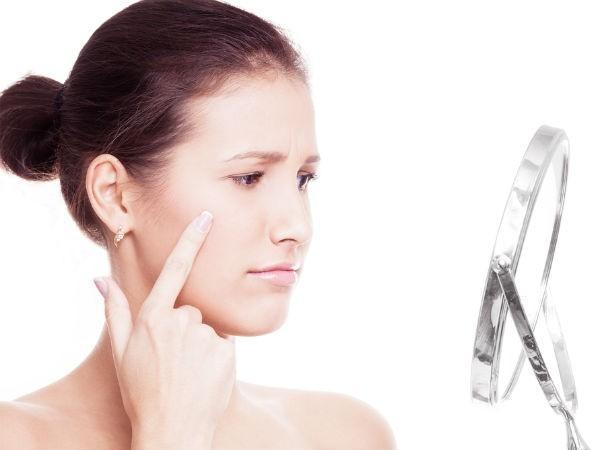 Biết cách xử lý vùng da bị mụn đúng cách