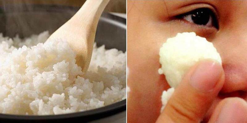 Trị mụn đầu đen bằng cơm nóng là phương pháp đơn giản và hiệu quả