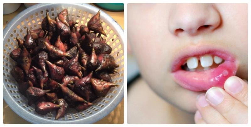 Dùng củ ấu kết hợp các vị thuốc để chữa mụn nhọt nhiệt miệng ở trẻ nhỏ