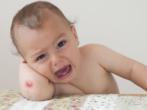 Trị mụn nhọt ở trẻ nhỏ bằng củ ấu
