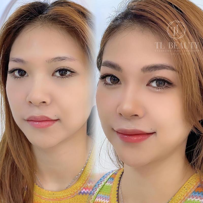 Trung Middle - TL Beauty SaiGon Center