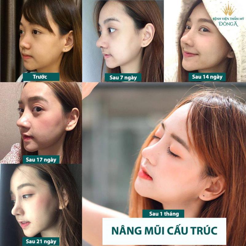 Bệnh viện thẩm mỹ Đông Á