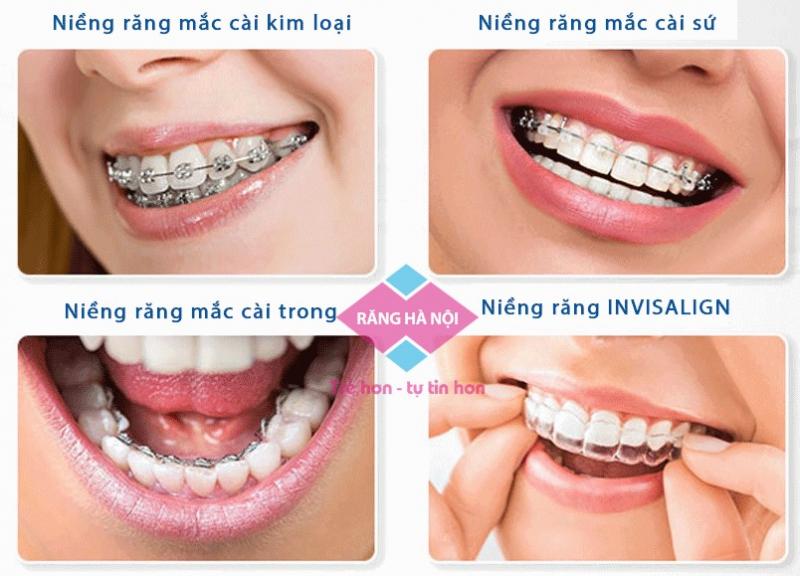 Trung tâm Răng Hà Nội