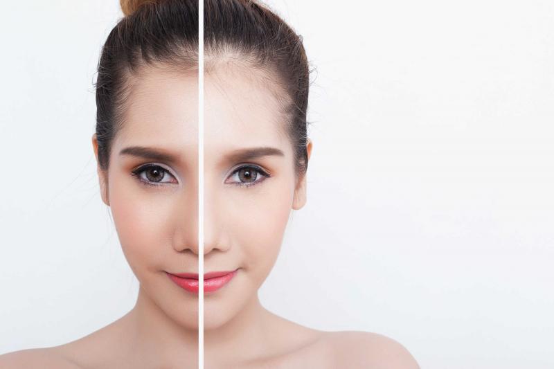 Uống nước ấm làm sáng làn da của bạn