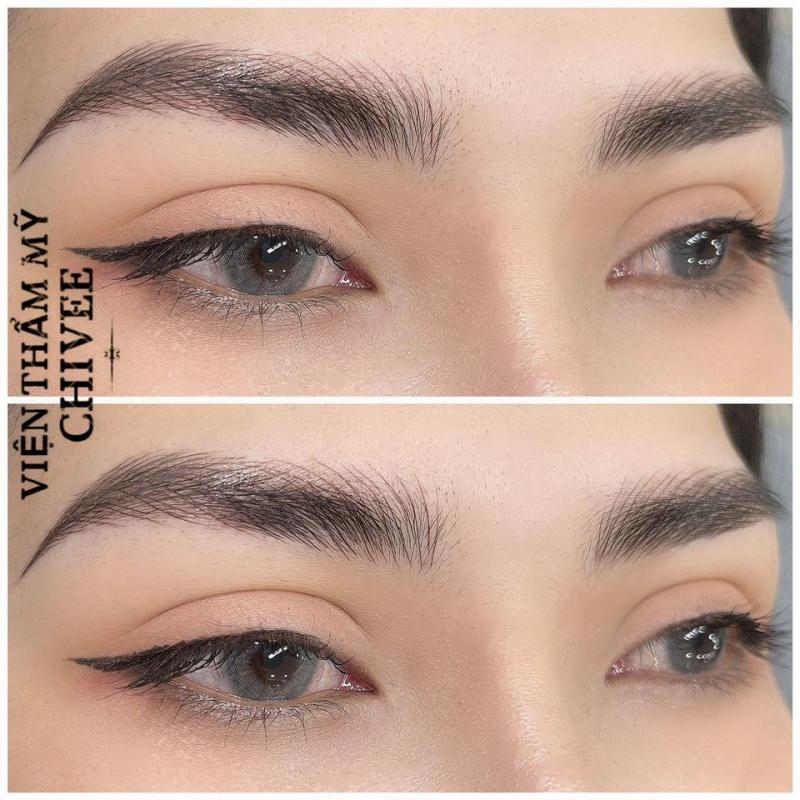Viện Thẩm Mỹ ChiVee