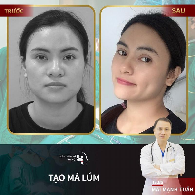 ﻿Viện thẩm mỹ Hà Nội