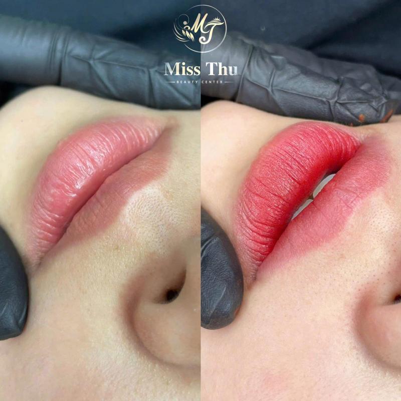 Viện Thẩm Mỹ Miss Thu